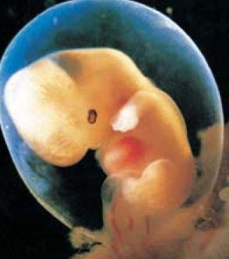 怀孕2个月胎儿图-怀孕11周的胎儿图片